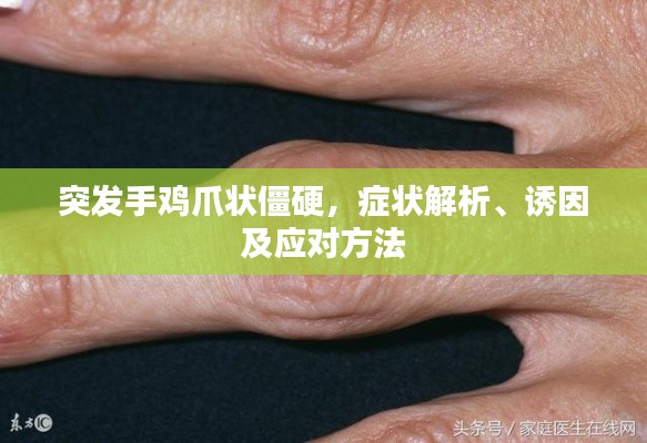 突发手鸡爪状僵硬,症状解析、诱因及应对方法